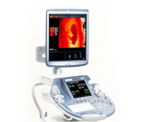 High Definition Sonography