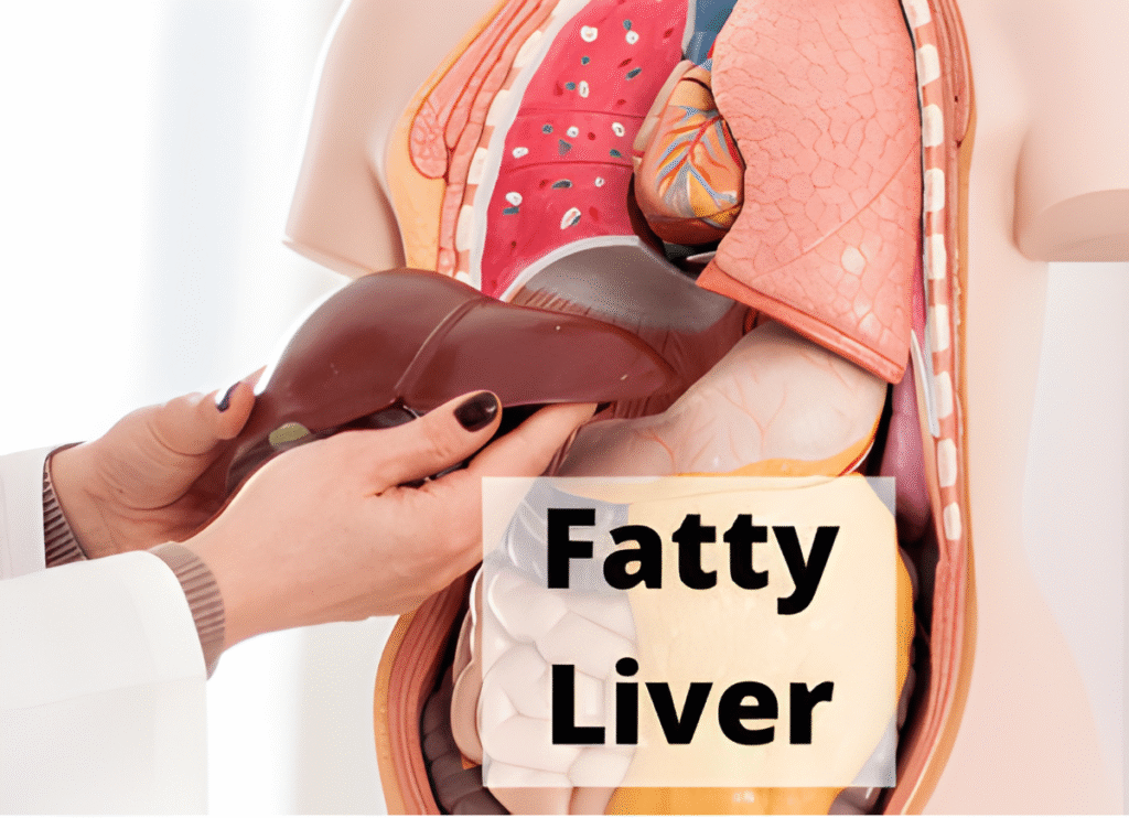 fatty liver problem