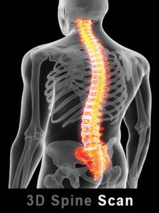 3D Spine Scan at Arth Diagnostics