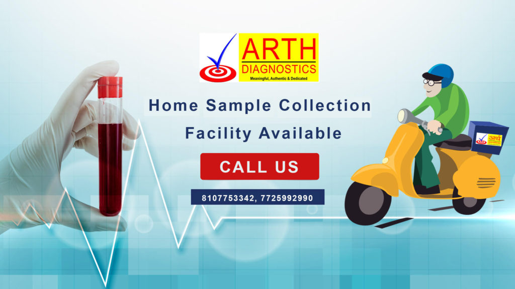 We at Arth diagnostics provide Home Sample Collection Facility. Arth
