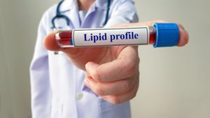 lipid profile test in udaipur - arth diagnostics