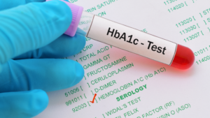 blood sugar test in Udaipur - Arth Diagnostics