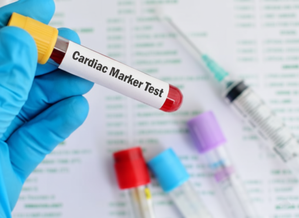 cardiac profile test in udaipur