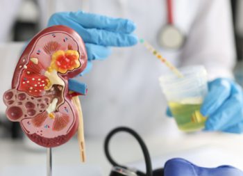 Kidney Function Test in Udaipur, Renal Function Test in Udaipur