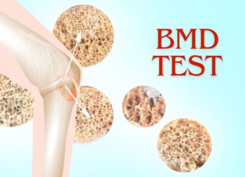 Bone Mineral Density Test in Udaipur, BMD Test in Udaipur, BMD Lab Test in Udaipur, DEXA Test in Udaipur, Arth Diagnostics