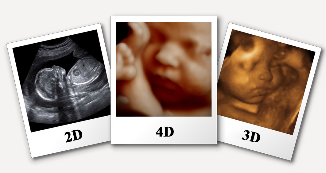 best sonography center in Udaipur | 3d/4d ultrasound