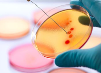 Benefits of Microbiology Tests in Early Diagnosis