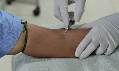 Full Body Check-up in Udaipur - Arth Diagnostics