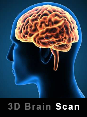 3d brain scan in udaipur | arth diagnostics