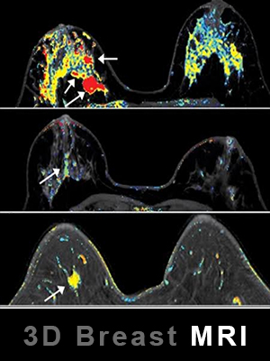 3d breast mri center in udaipur - arth diagnostics