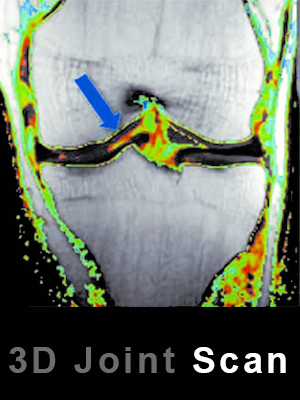 3d joint scan at arth diagnostics in udaipur