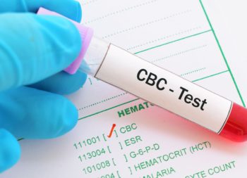 Complete Blood Count (CBC) Test in Udaipur - arth diagnostics