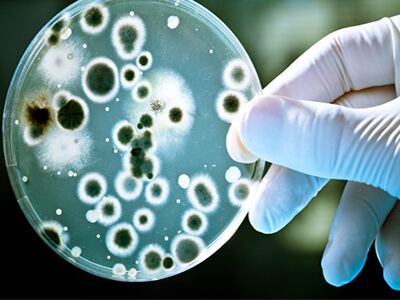 Microbiology in Udaipur