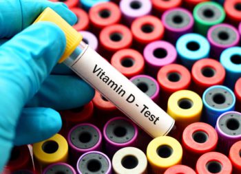 vitamin d test in udaipur - arth diagnostics