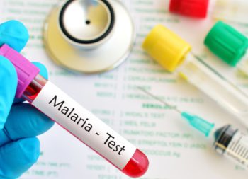 malaria test in udaipur - arth diagnostics