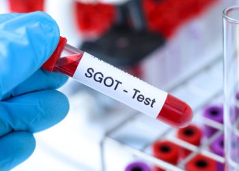 sgot test in udaipur - arth diagnostics