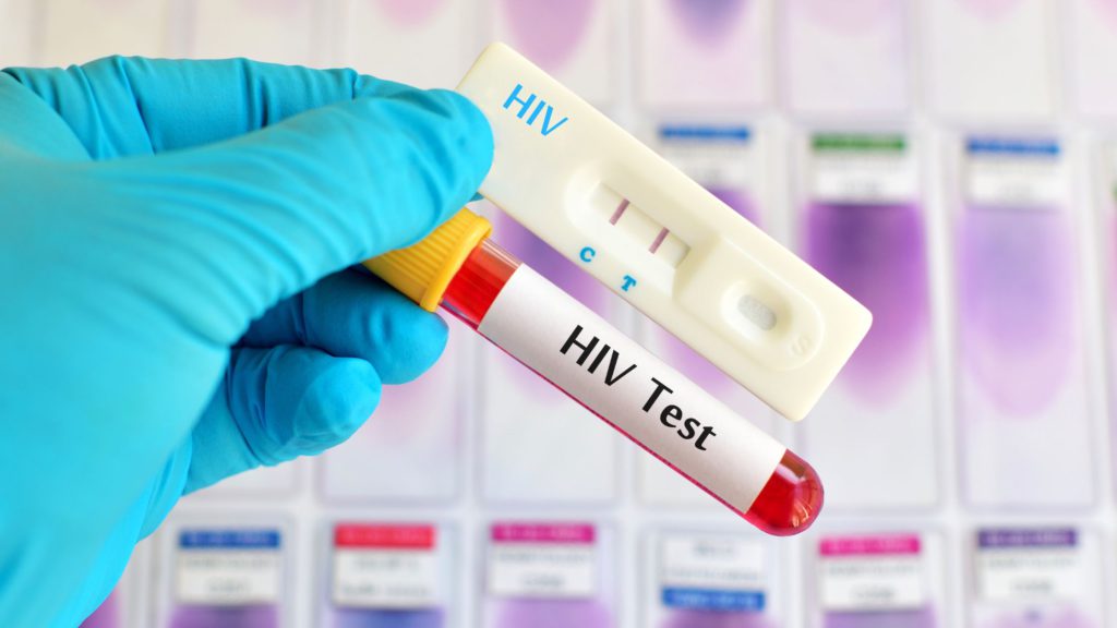hiv test in udaipur - arth diagnostics