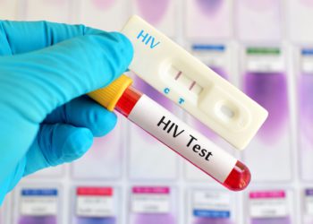 hiv test in udaipur - arth diagnostics