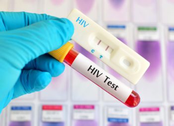 hiv test in udaipur - arth diagnostics