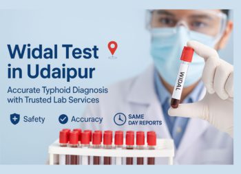 widal test in udaipur - arth diagnostics