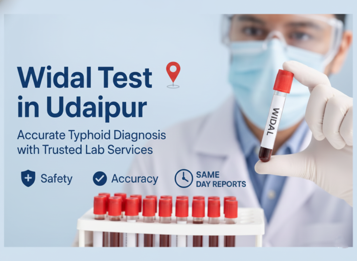 widal test in udaipur