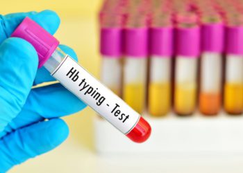 Hemoglobin (Hb) Test in Udaipur | Arth Diagnostics