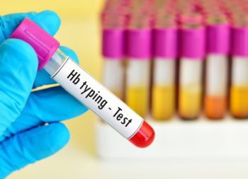 Hemoglobin (Hb) Test in Udaipur | Arth Diagnostics