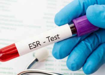ESR Test in Udaipur - Arth Diagnostics