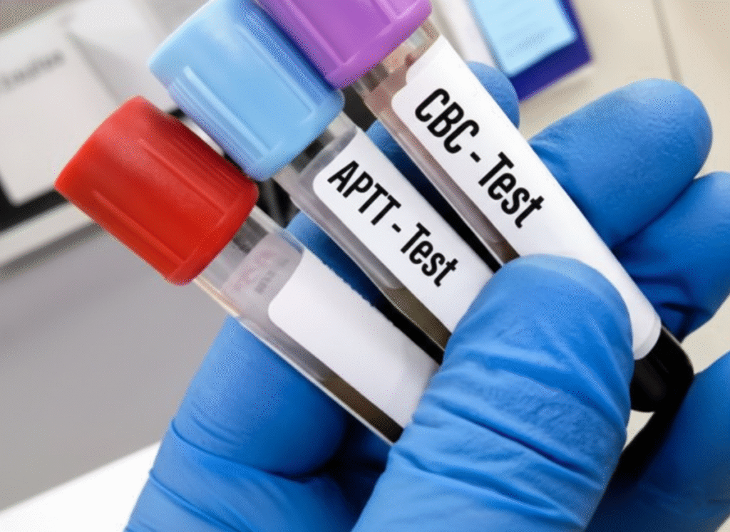 APTT test in udaipur