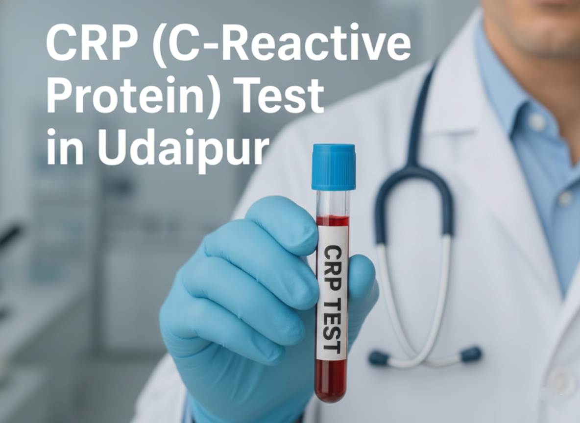 CRP (C-Reactive Protein) Test in Udaipur