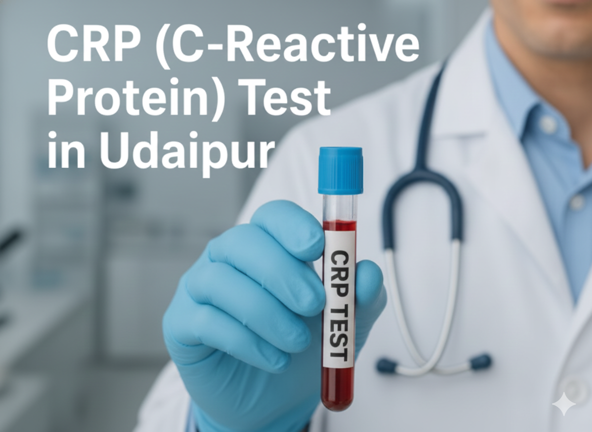 CRP (C-Reactive Protein) Test in Udaipur