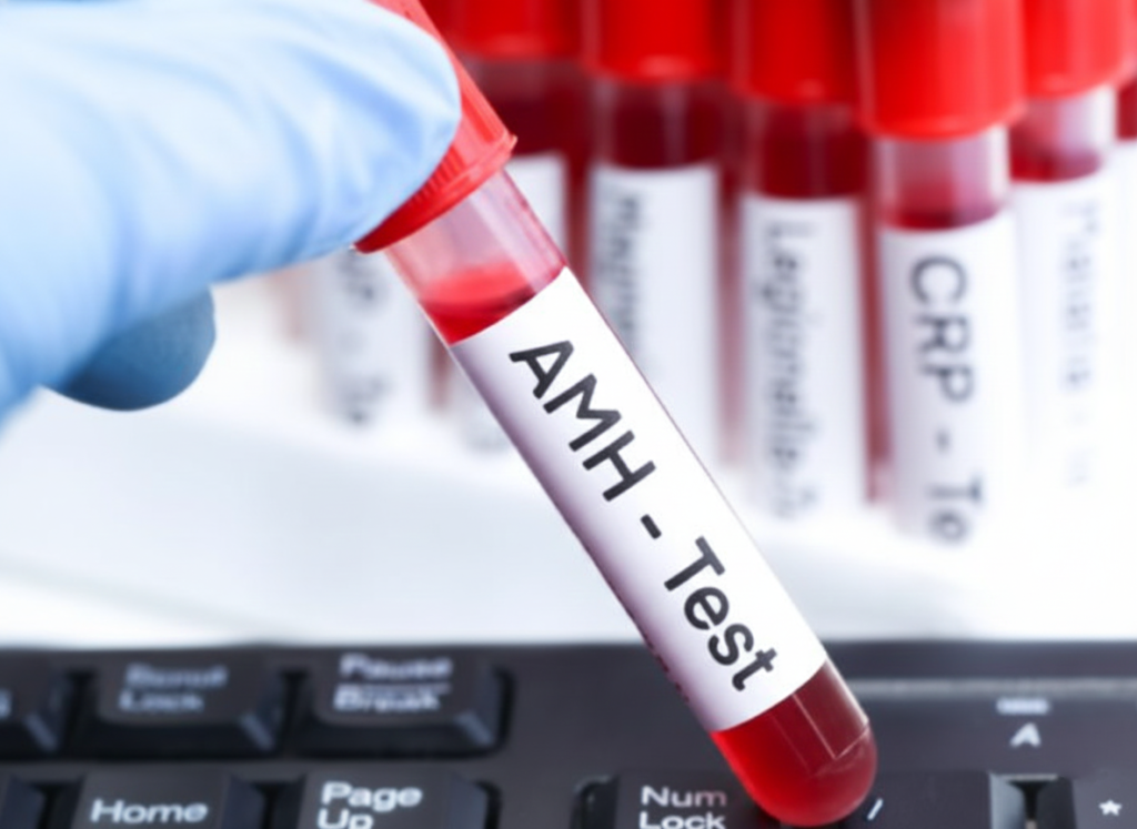 AMH Test in Udaipur